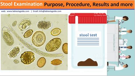 Stool Examination | Lab Tests Guide