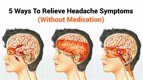 4 Types of Headaches You Should Never Ignore