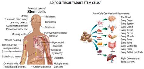 STEM CELL THERAPY — Holland Stem Cells