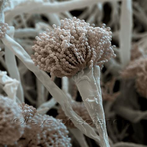 Bacteria and Fungus seen in the Scanning and Transmission Electron Microscope | Microscopic ...