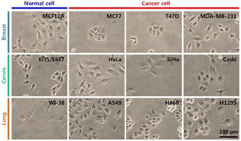 Optical images both normal cell and three kinds of different cancer ...