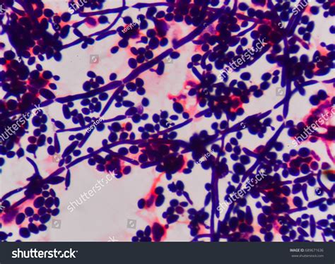 Budding Yeast Cell Structure Fine Microscope Stock Photo (Edit Now ...