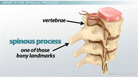 Spinous Process: Function & Fracture Treatment - Video & Lesson Transcript | Study.com