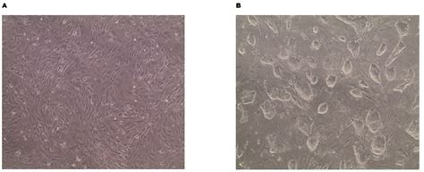 Mouse Embryonic Fibroblasts (MEF Feeder Cells)