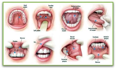 Oral Cancer