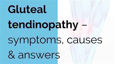 Gluteal tendinopathy - symptoms, causes & answers - Sports Injury | Online