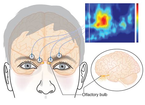 Olfactory: electrode placement for olfactory cortex recording ...