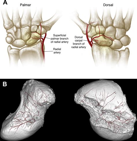 Diagnosis and Management of Acute Scaphoid Fractures - Hand Clinics