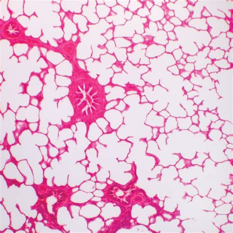 Human Lung Slide, 7 µm, H&E | Carolina Biological Supply