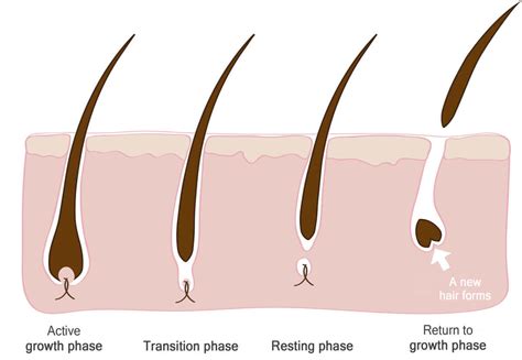 Histopathology of Hair Loss - Regrowth. Your Source Of Hair News