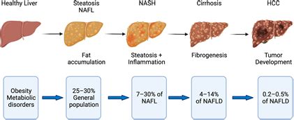 Fatty Liver Disease