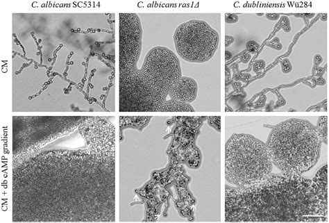 Frontiers | Candida species Rewired Hyphae Developmental Programs for Chlamydospore Formation ...