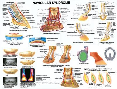 Navicular Syndrome Chart-www.hoofprints.com