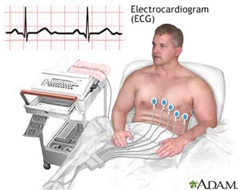 Tin Tức Cao Niên Thế Kỷ XXI: Phân nửa các ca nhồi máu cơ tim có thề là thầm lặng