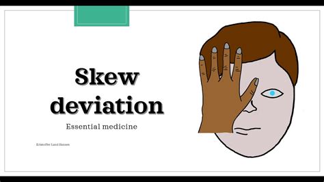 Skew deviation test / Test of Skew [Essential medicine] - YouTube