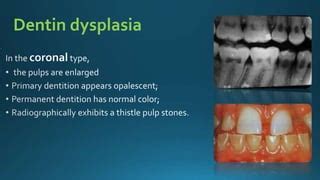 Inherited dentin defects (Dentistry) | PPT