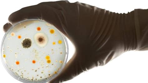 Are bacteria alive? - Kidpid