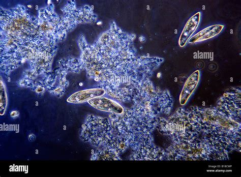 Paramecium in pond water under optical microscope Stock Photo, Royalty ...