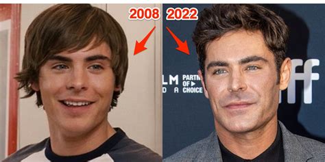 Zac Efron 'Almost Died' in Accident That Shattered His Jaw - Business ...