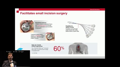 Edwards Intuity Elite Valve System - Perfusion.com