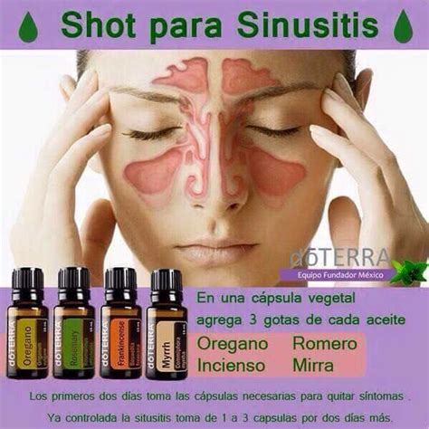 #Sinocitis #doterra | Recetas de aceites esenciales, Doterra, Aceite romero