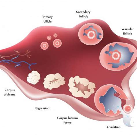 Ovarian cyst. Pain in the right groin in females. Causes and Treatment - All information about cysts