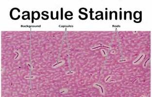 Capsule Staining- Principle, Reagents, Procedure and Result. The main purpose of capsule stain ...