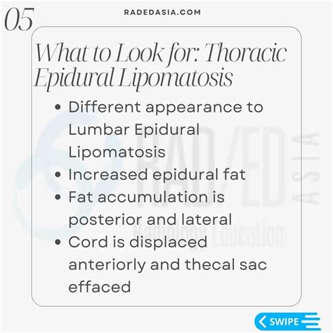 EPIDURAL SPACE INVADERS: SPINE MRI EPIDURAL LIPOMATOSIS PART 2 - Radedasia