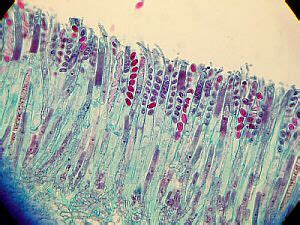 Peziza close-up of asci and ascospores | Fungi, Close up, Save