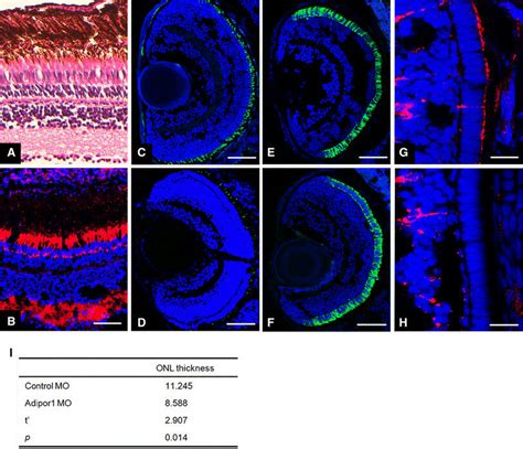 Inhibition of rod photoreceptor development by knockdown of adipor1... | Download Scientific Diagram