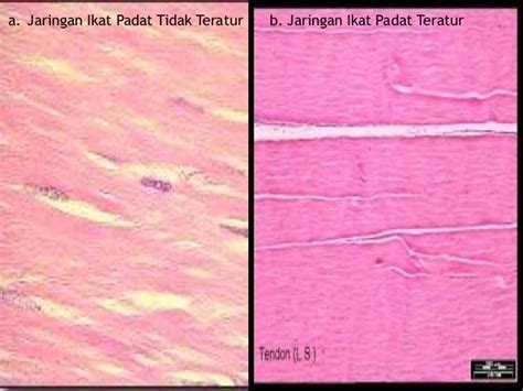 Jaringan Ikat