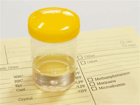 How To Keep A Urine Sample Warm - Aimsnow7