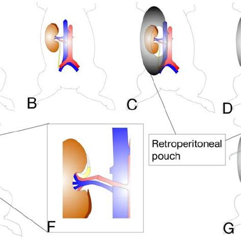 (PDF) Appraisal of the porcine kidney autotransplantation model