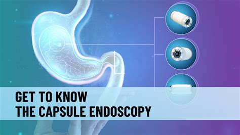 GET TO KNOW THE CAPSULE ENDOSCOPY - ISDE