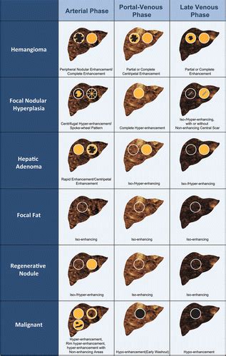 Hepatic Lesions Mri Chart