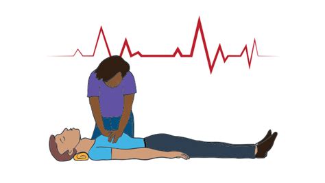 Guide to CPR | DisasterReady