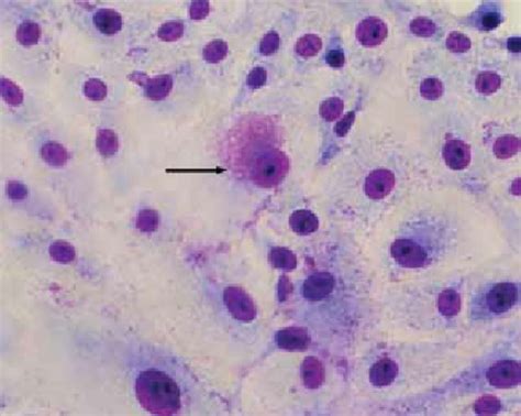 Estructuras internas y externas a la pared celular bacteriana (Estructuras…