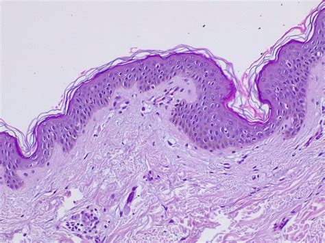 Normal Epidermis Histology | My XXX Hot Girl