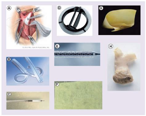 Examples of various biomaterials used in cardiovascular products | Download Scientific Diagram