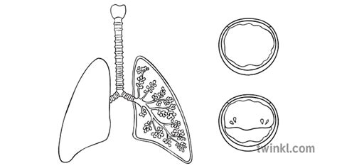 Cystic Fibrosis Lungs Mucus Diagram Unlabelled Genetic Genes Science