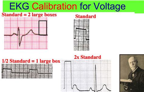 Calibration