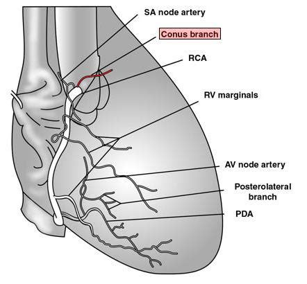 The Pump and the Tubes: The Third Coronary Artery? (the conus artery)