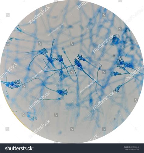 10 imágenes de Penicillium sp - Imágenes, fotos y vectores de stock | Shutterstock