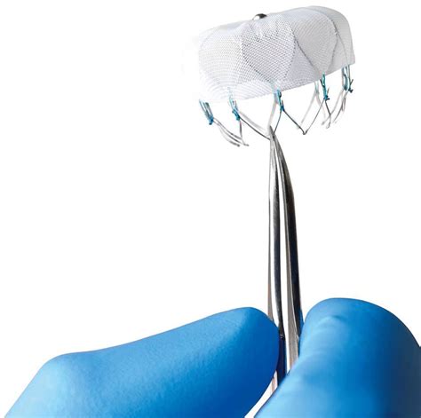 Boston Scientific Receives FDA Approval for Watchman™ Left Atrial Appendage Closure Device