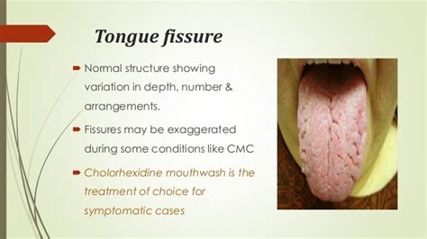 Diseases of lips & tongue