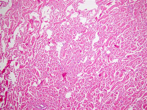 Ligamentum Nuchae Histology