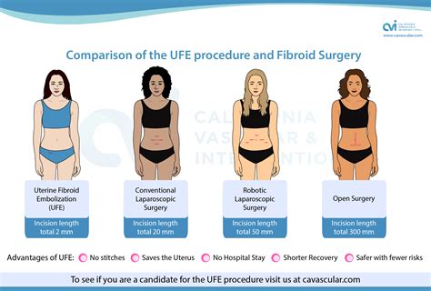 Scar Specialist - UFE, Fibroid, Myomectomy & Hysterectomy