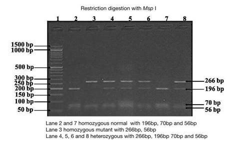 Part 2: Analysing and Interpreting (Agarose) Gel Electrophoresis Results