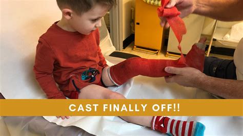 HARRY FINALLY GETS HIS CAST OFF AFTER 6 WEEKS! | TODDLER FULL LEG CAST ...