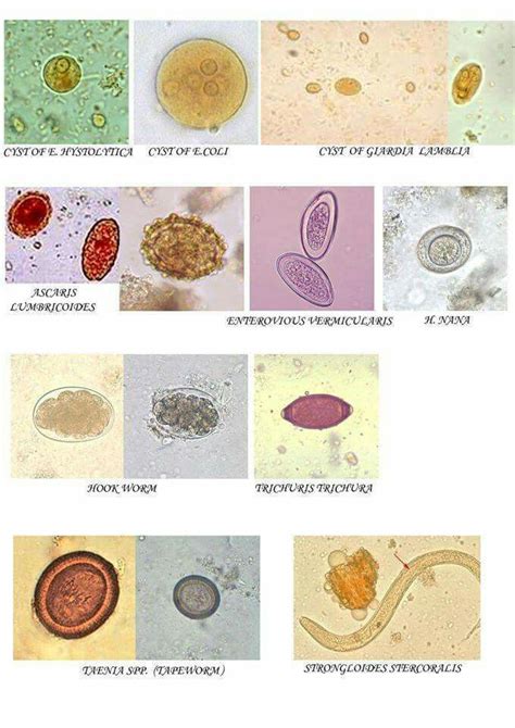 Para atlas | Medical laboratory, Medical laboratory science, Medical laboratory technician